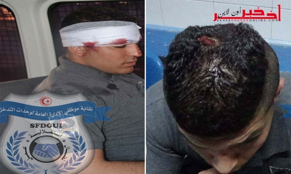 بالصور/ إصابات متفاوتة الخطورة لـ 7 أعوان أمن في أحداث شغب بعد نهائي كأس تونس لكرة السلة